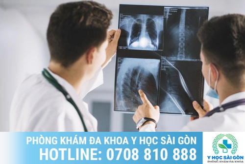 Doctors watching x-ray shot