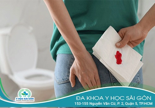 Đi vệ sinh ra máu ở nữ giới là bệnh gì?